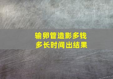 输卵管造影多钱 多长时间出结果